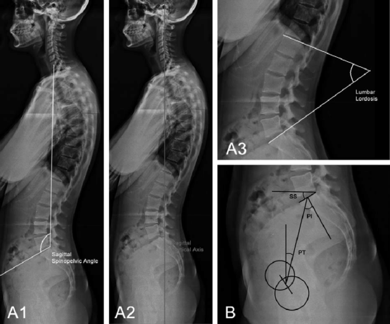 RADIOGRAFIA PANORAMICA COLUMNA TOTAL